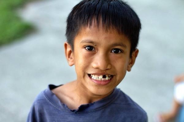 Young boy with a missing tooth.